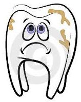 Tooth Cavities Fillings Chandler Gilbert AZ 85225